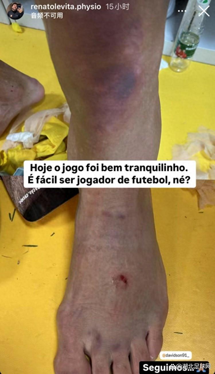 勒沃库森中场核心